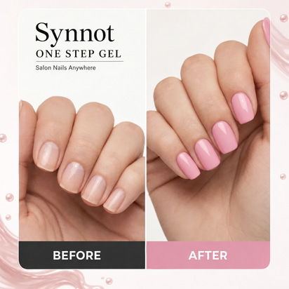 Synnot before and after